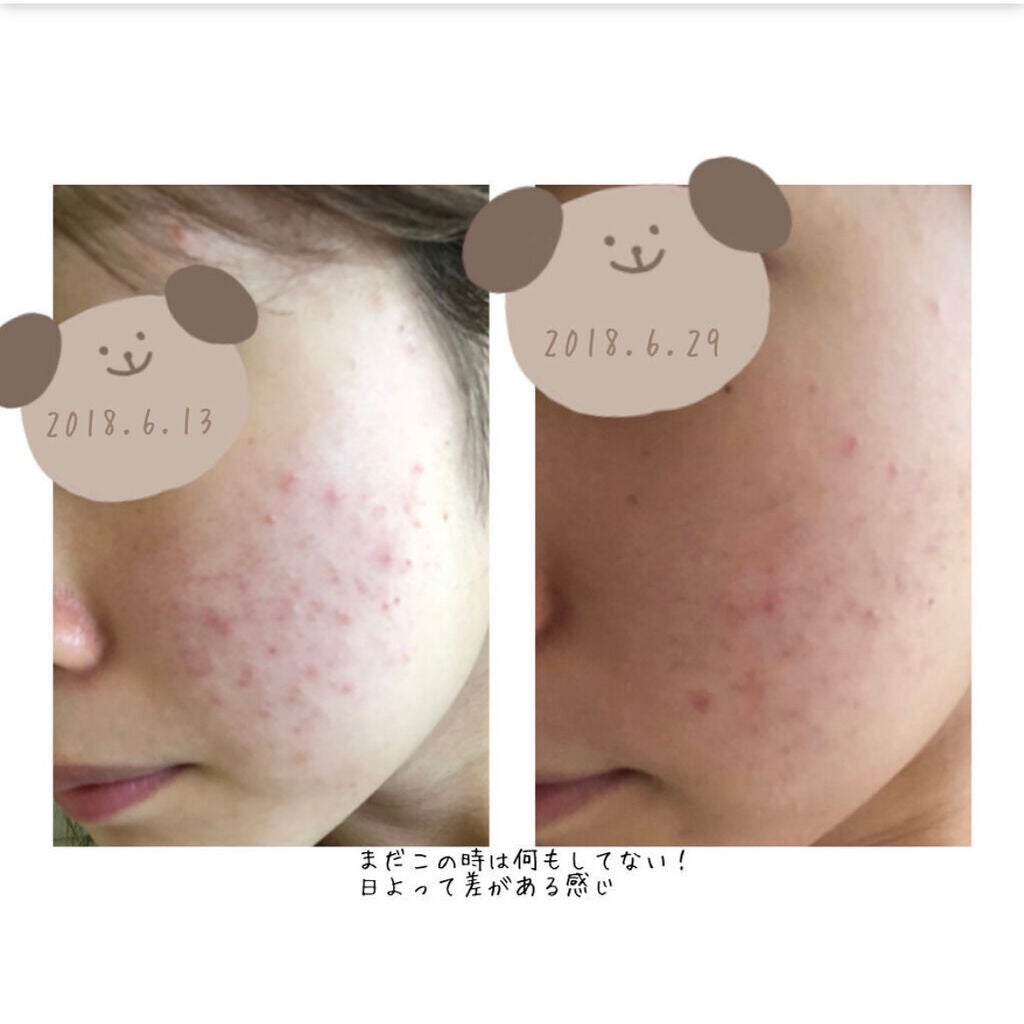 ザ・タイムR アクア/IPSA/化粧水を使ったクチコミ(2枚目)