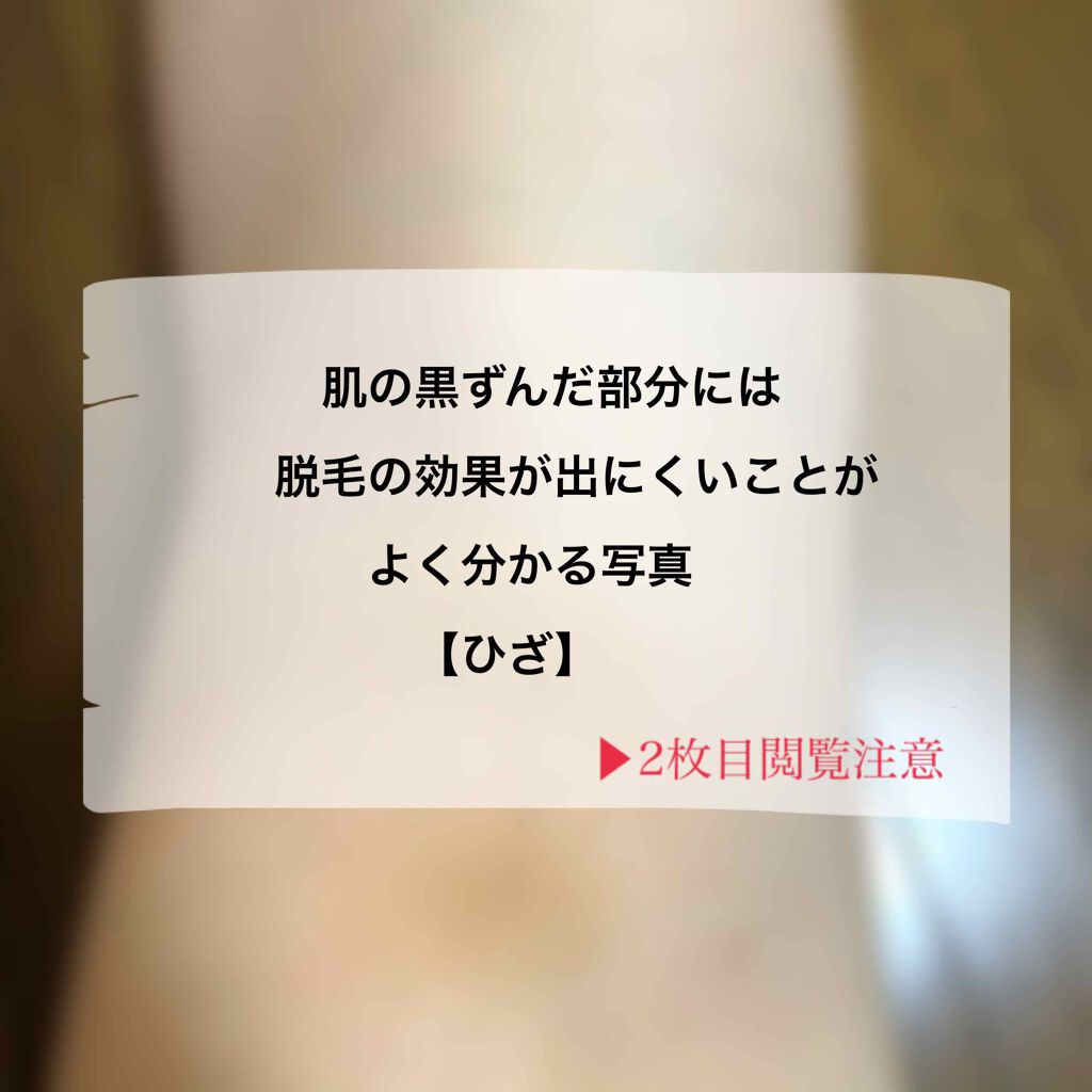 sari on LIPS 「⚠︎2枚目以降毛の写真が出てきます。前回カミソリで処理してから..」(1枚目)