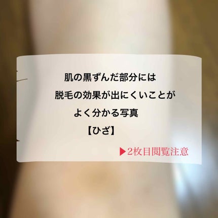 を使ったクチコミ(1枚目)