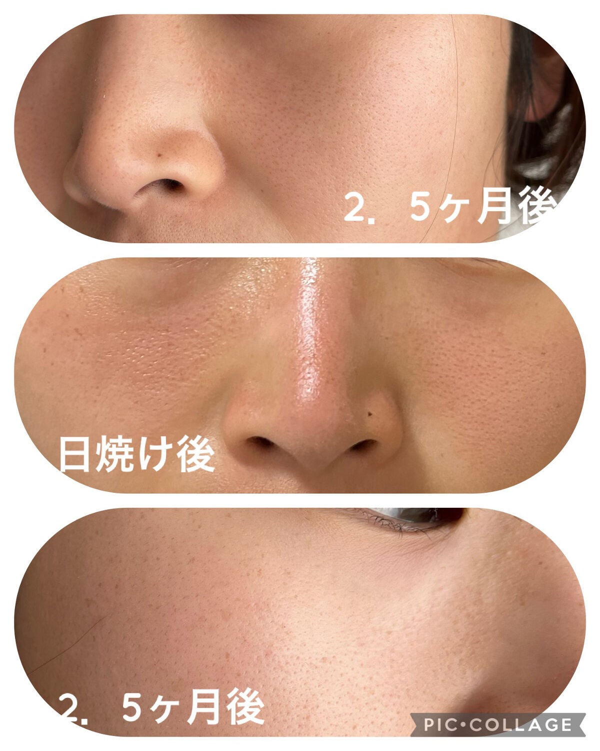 ビタペアC ジェルクリーム/ネイチャーリパブリック/フェイスクリームを使ったクチコミ(3枚目)