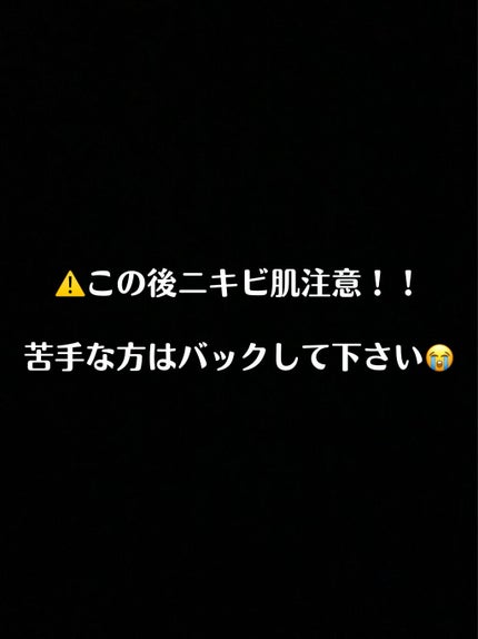 薬用ニキビケア スポッツクリーム/アクネスラボ/フェイスクリームを使ったクチコミ(2枚目)