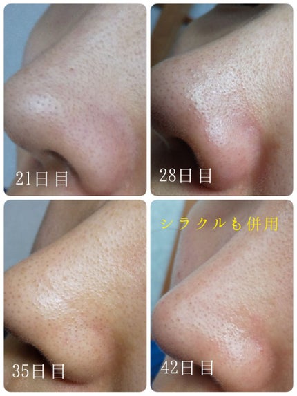 デュオ ザ クレンジングバーム クリア/DUO/クレンジングバームを使ったクチコミ(3枚目)