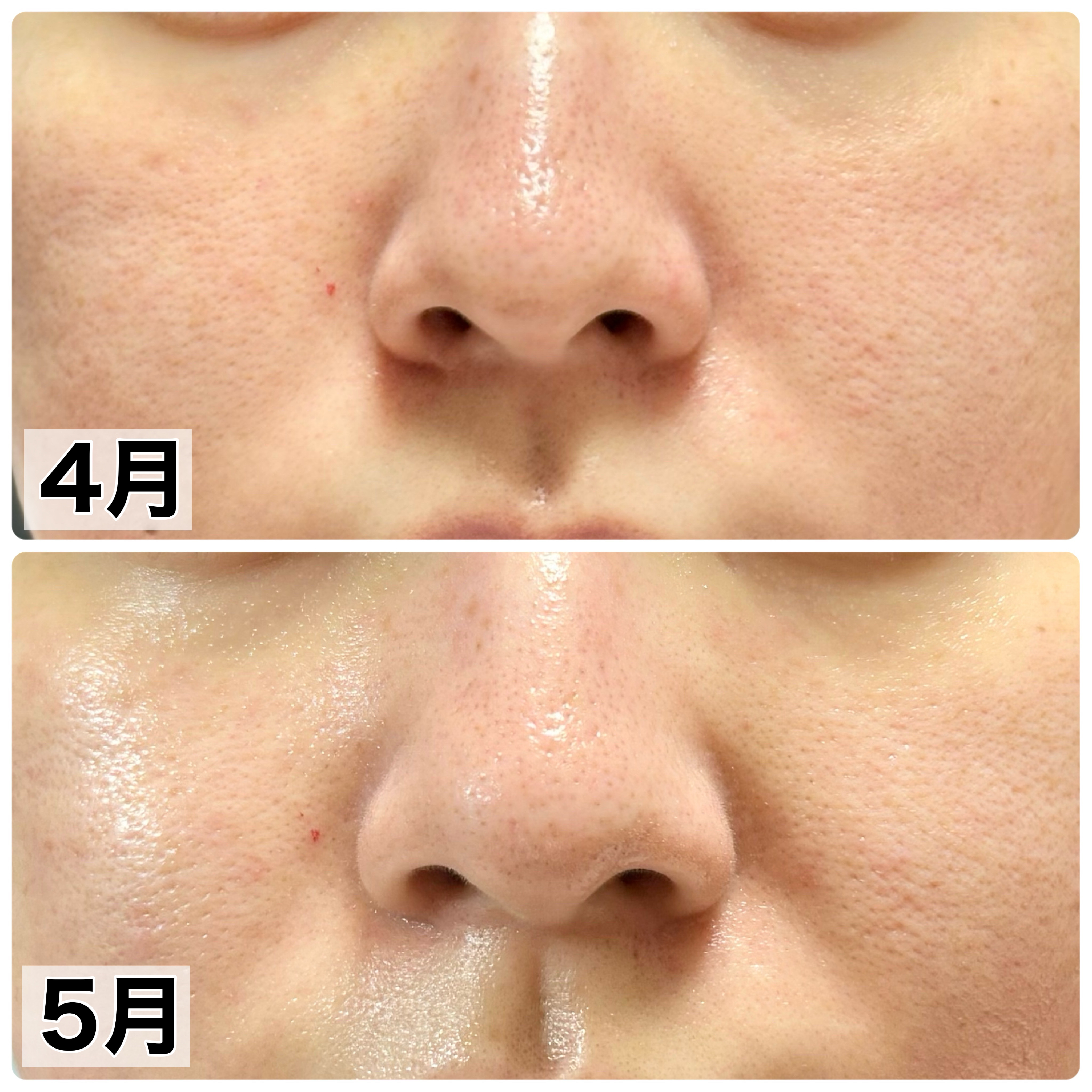 極潤 薬用ハリ乳液【医薬部外品】/肌ラボ/乳液を使ったクチコミ（2枚目）