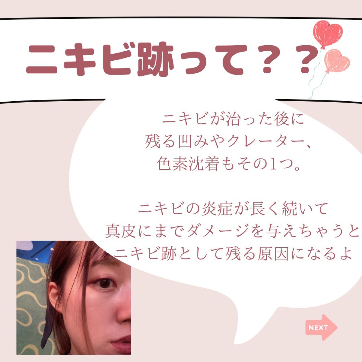 薬用 しみ 集中対策 美容液/メラノCC/美容液を使ったクチコミ(3枚目)