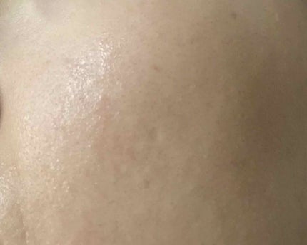 tomto on LIPS 「👱🏻♀️美容皮膚科医が監修乾燥性敏感肌のためのクレンジング💆..」(3枚目)