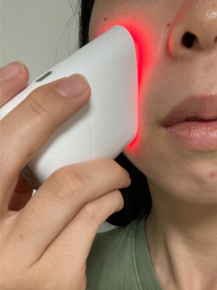 スキンライトセラピーII/Makeon/美顔器・マッサージを使ったクチコミ(7枚目)