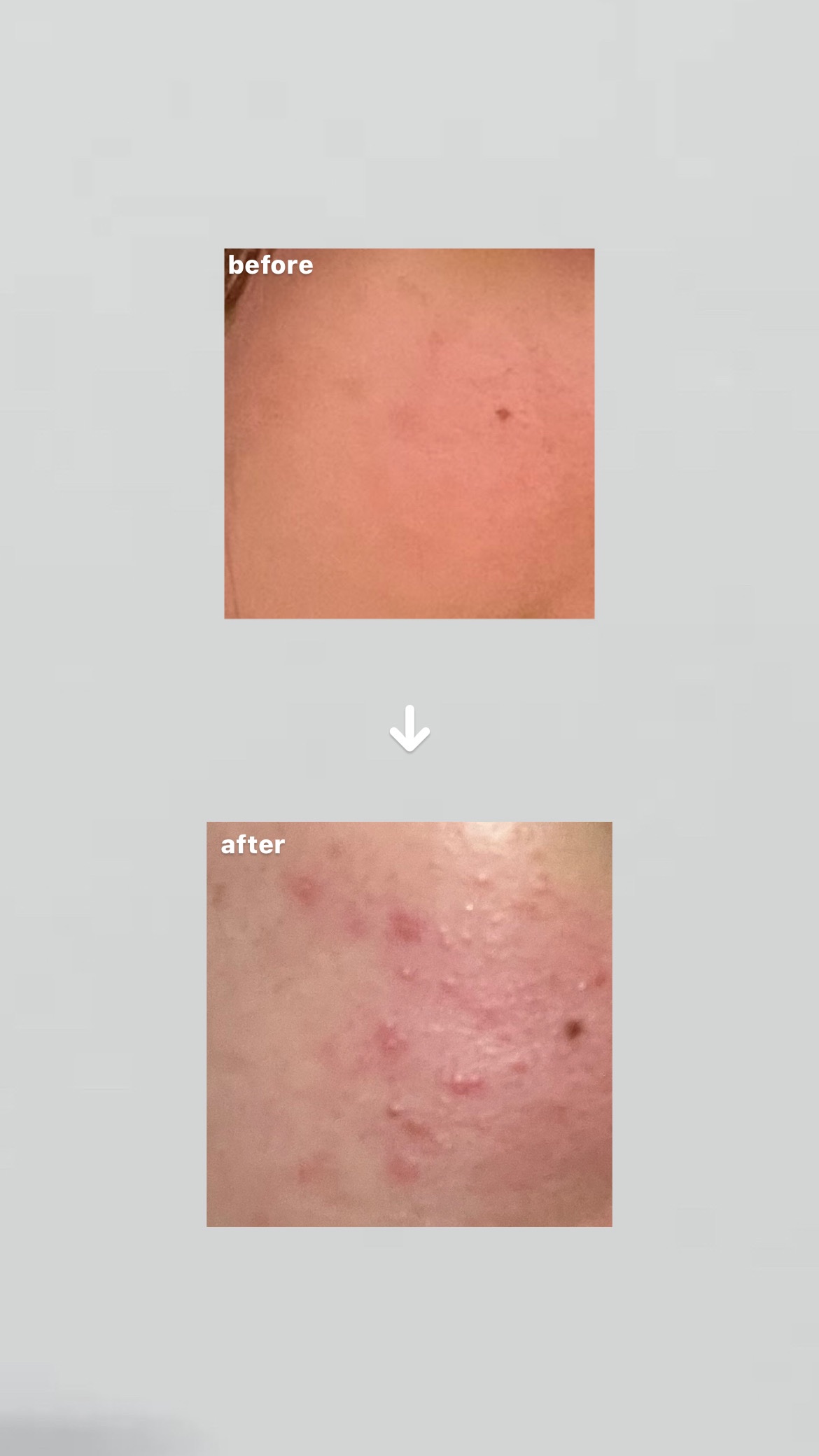 桃70%ナイアシンセラム/Anua/美容液を使ったクチコミ（2枚目）