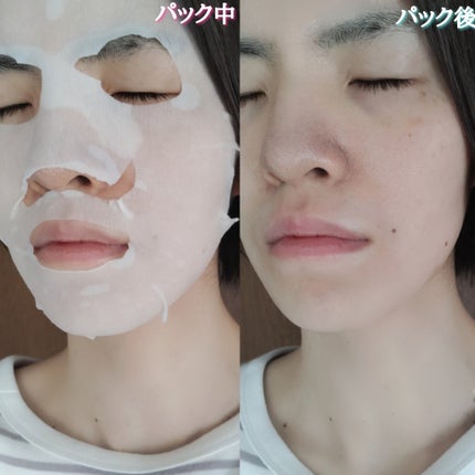 ルルルンプレシャス GREEN(バランス)【旧】/ルルルン/シートマスク・パックを使ったクチコミ(5枚目)