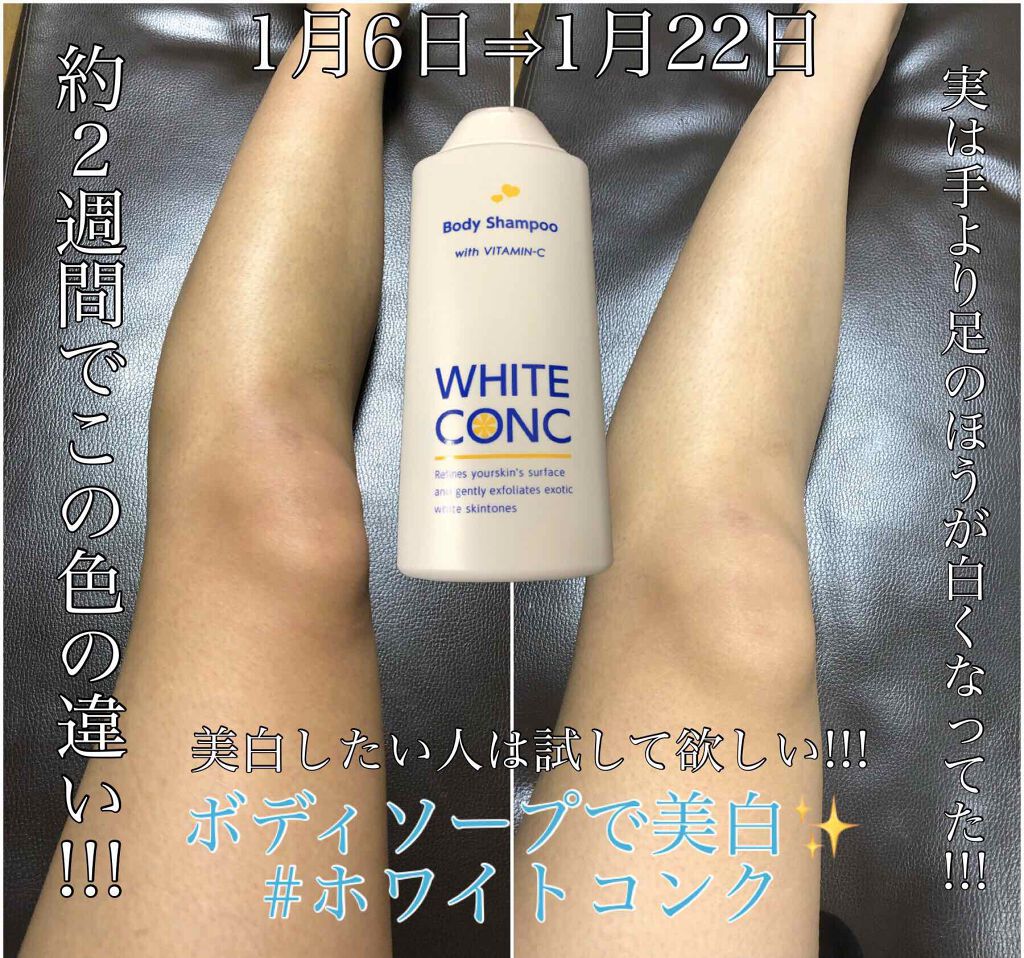 ホワイトコンクホワイトニングcc