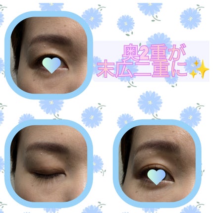 TWOOLダブルアイリッドハイブリットフィルム/SHOBIDO/二重まぶた用アイテムを使ったクチコミ(2枚目)