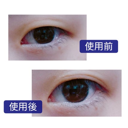 就寝用ふたえくせづけグルー/プレビュート/二重まぶた用アイテムを使ったクチコミ(4枚目)