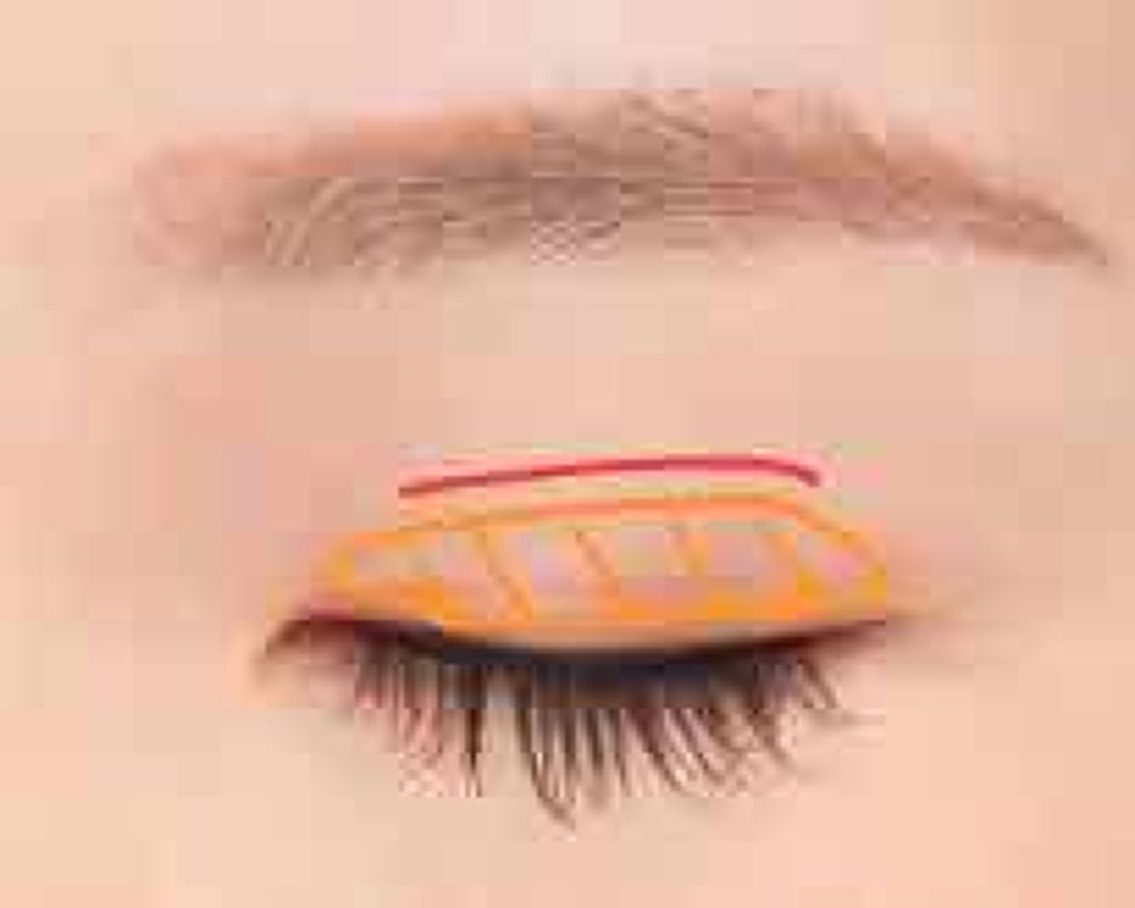 ルドゥーブル/ルドゥーブル/二重まぶた用アイテムを使ったクチコミ（2枚目）