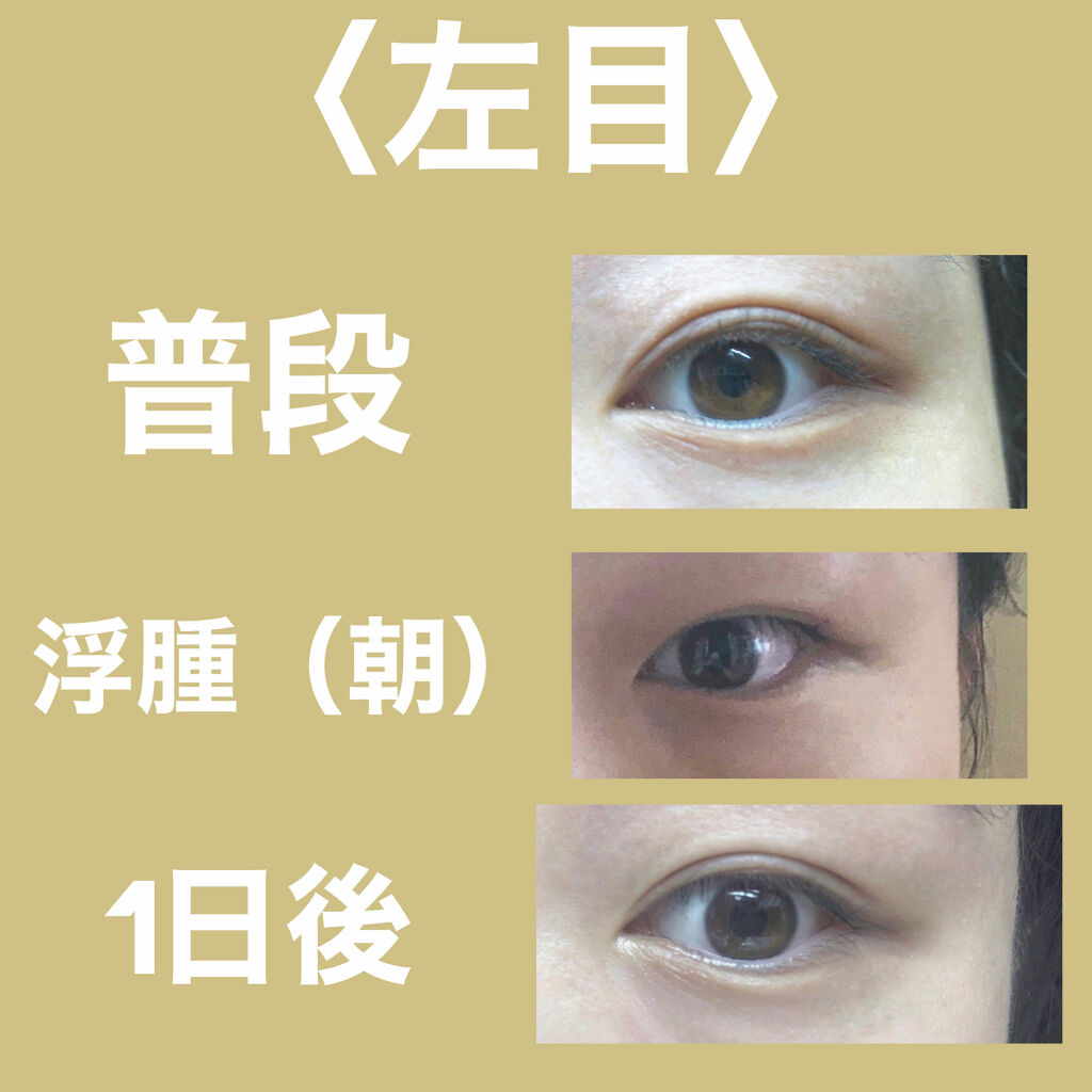 のびーるアイテープ（絆創膏タイプ、レギュラー）/DAISO/二重まぶた用アイテムを使ったクチコミ（3枚目）