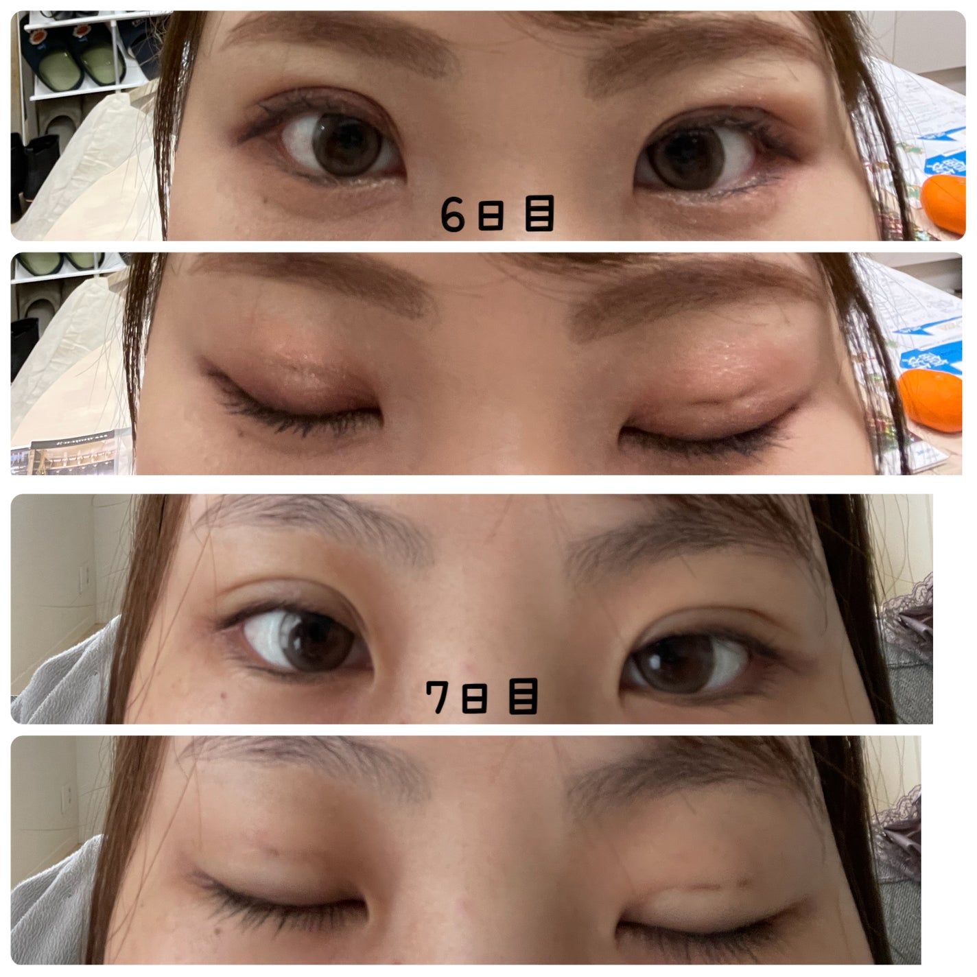 ナイトアイボーテ/StreeTrend/二重まぶた用アイテムを使ったクチコミ(7枚目)