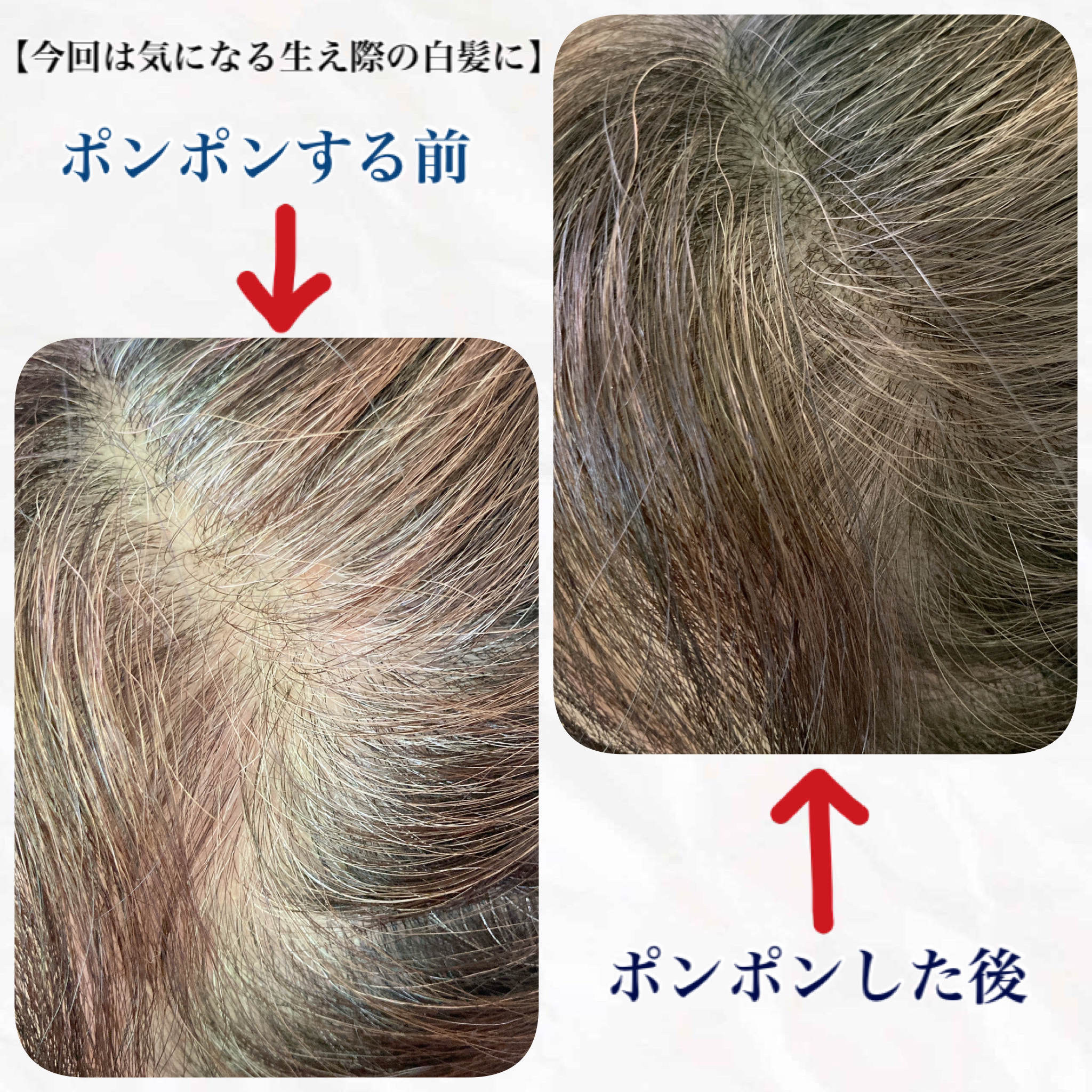 コスメジタン モンジューヌ ヘアマジカパウダー/シーヴァ/頭皮ケアを使ったクチコミ（2枚目）