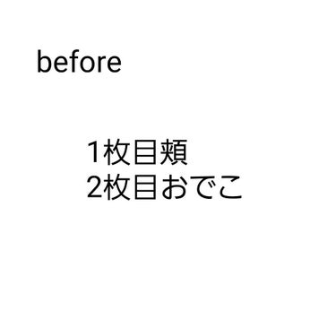 ドクダミ77% スージングトナー/Anua/化粧水を使ったクチコミ（3枚目）