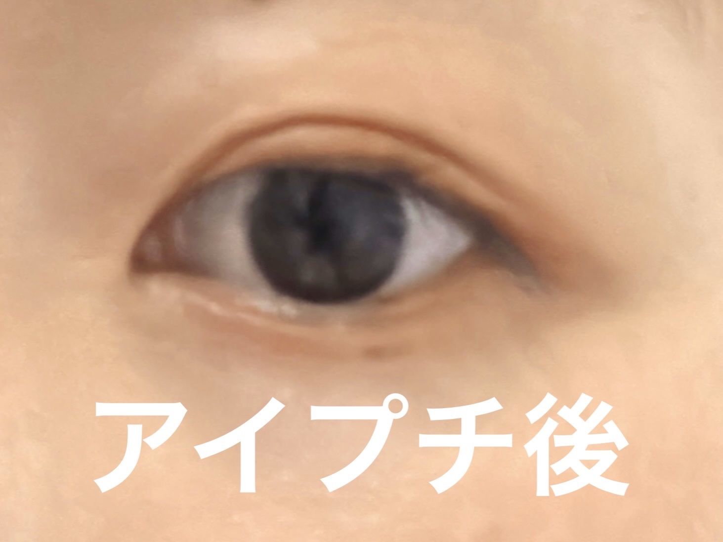 TWOOL ダブルアイリッドグルー/SHOBIDO/二重まぶた用アイテムを使ったクチコミ（3枚目）