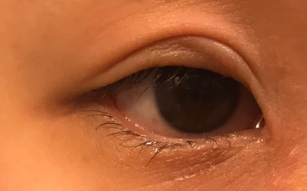 ズボラちゃん。 on LIPS 「⚠️洗顔前の汚い目の写真あり⚠️寝起きで目が腫れたりむくんだり..」(2枚目)