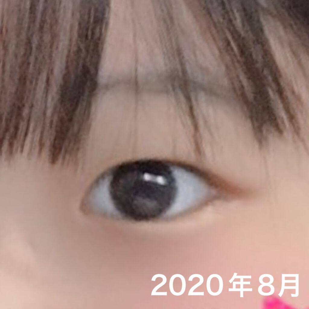 ワンダーアイリッドテープ Extra/D-UP/二重まぶた用アイテムを使ったクチコミ（2枚目）