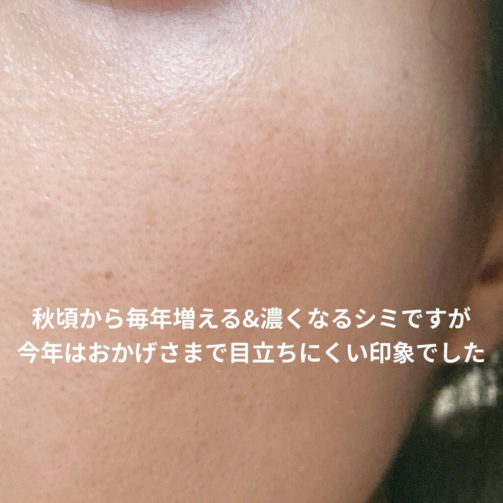 ホワイトCクリア(医薬品)/トランシーノ/その他を使ったクチコミ(3枚目)