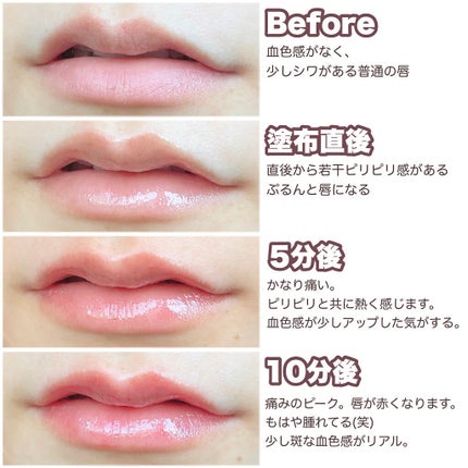 ドトムリッププラスプランパー/keybo/リッププランパーを使ったクチコミ(5枚目)