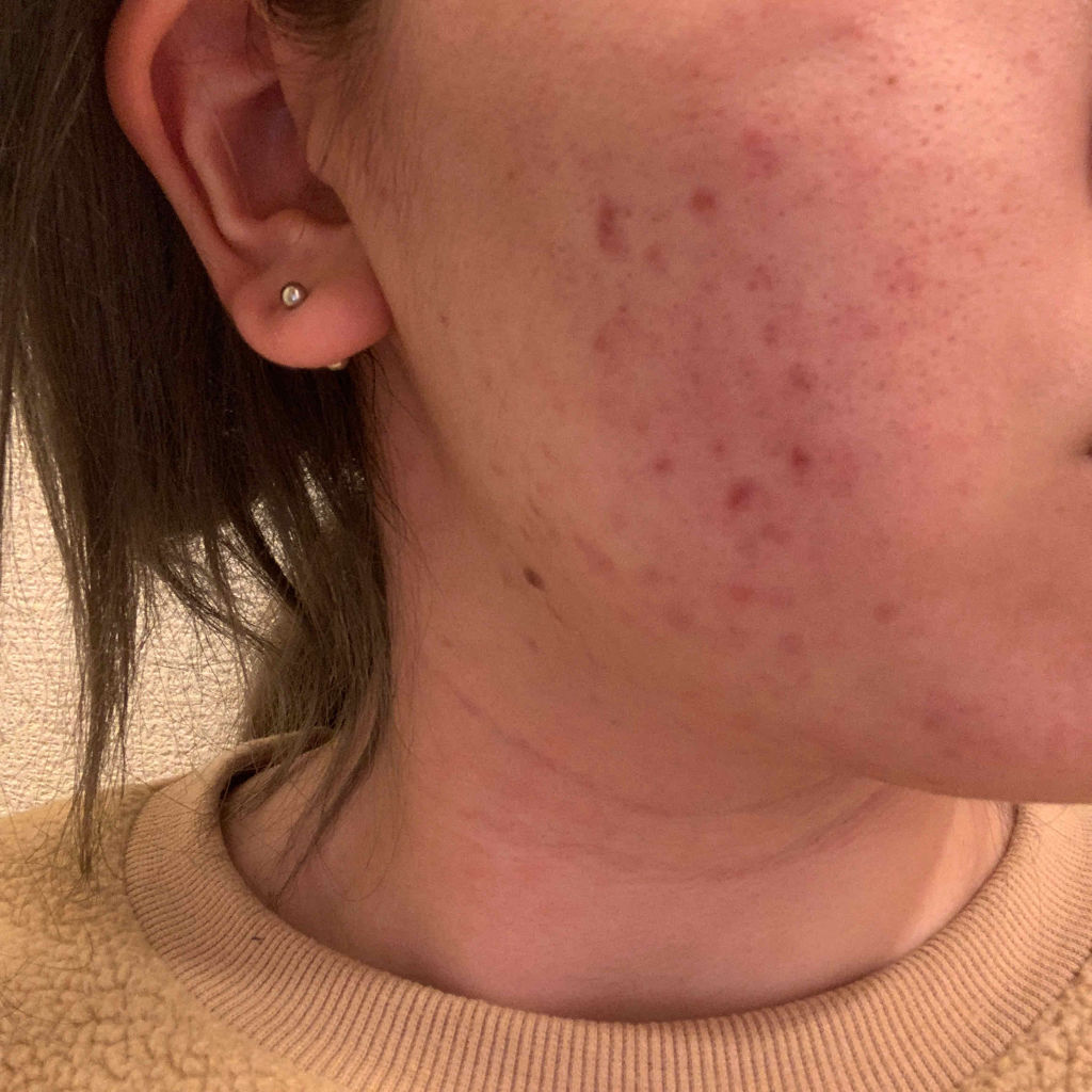 7 day Special Set プログラム3/b.glen/トライアルキットを使ったクチコミ（3枚目）