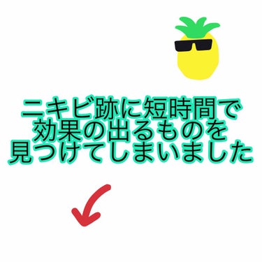 あさひ on LIPS 「ニキビ跡観察の途中ですが、神レベルに短時間でニキビ跡が薄くなる..」（1枚目）