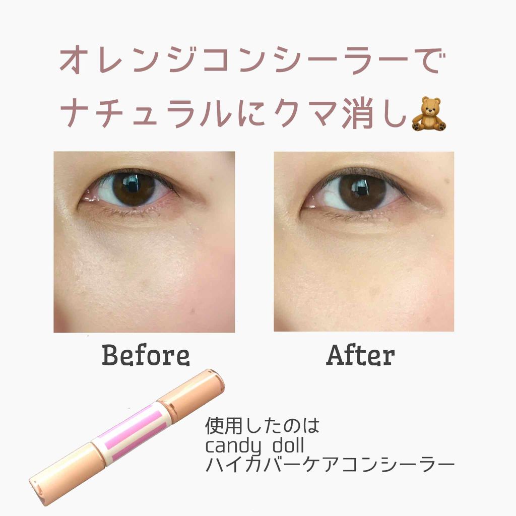ハイカバーケアコンシーラー/CandyDoll/リキッドコンシーラー by しましま