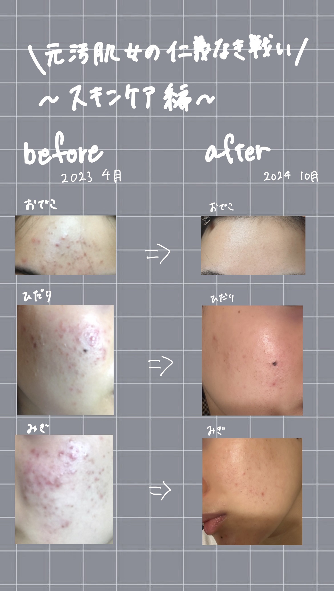 なめらか本舗 マイルド化粧水 NC/なめらか本舗/化粧水を使ったクチコミ（1枚目）