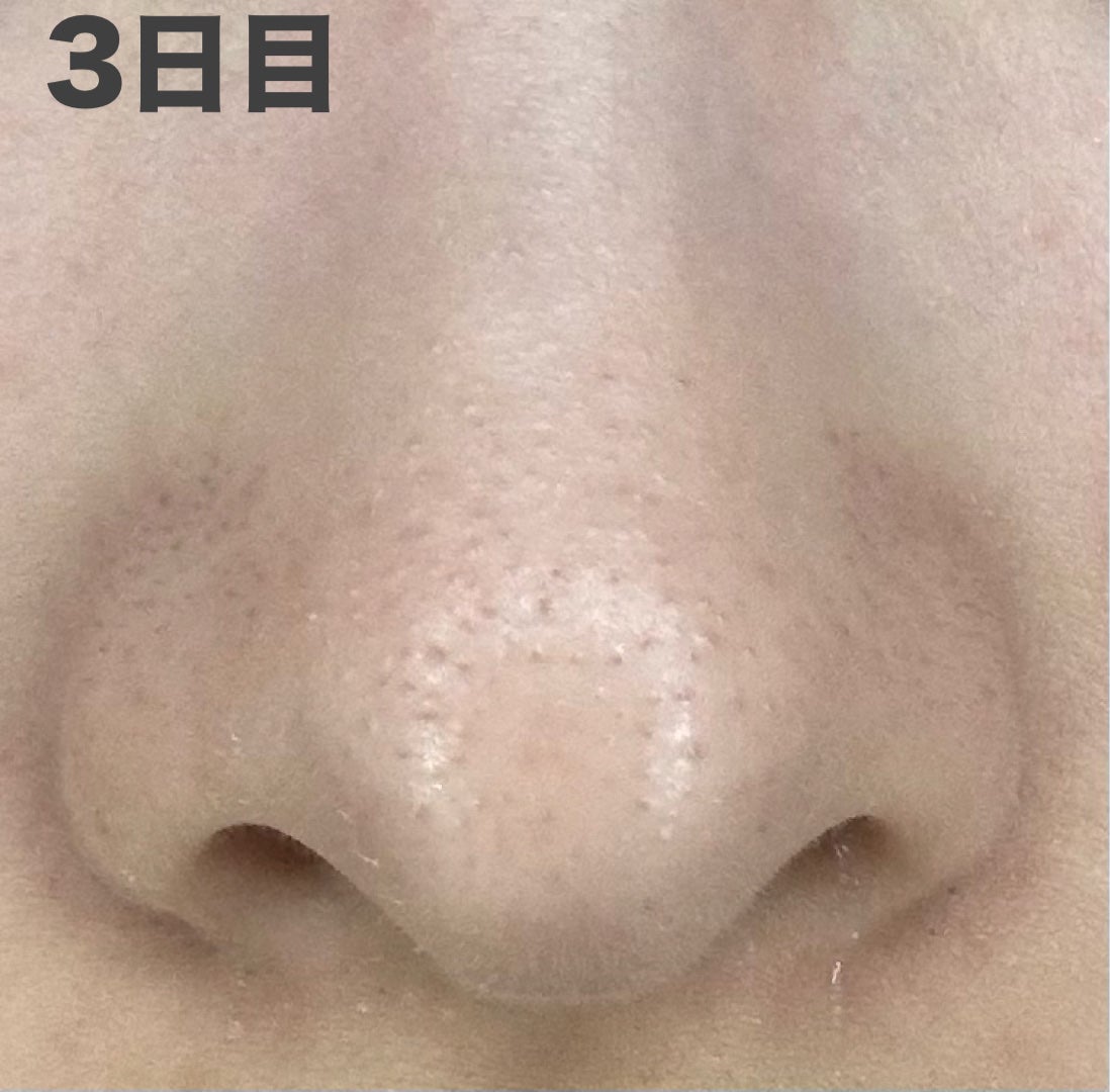 アンドハニー クレンジングバーム ブラック/&honey/クレンジングバームを使ったクチコミ(4枚目)