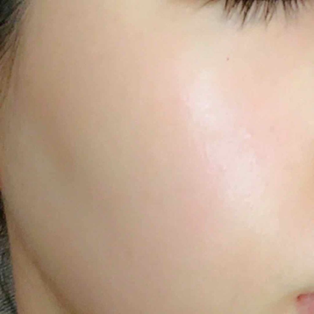 リバイバル ステムプラス/リッツ/美容液を使ったクチコミ(4枚目)