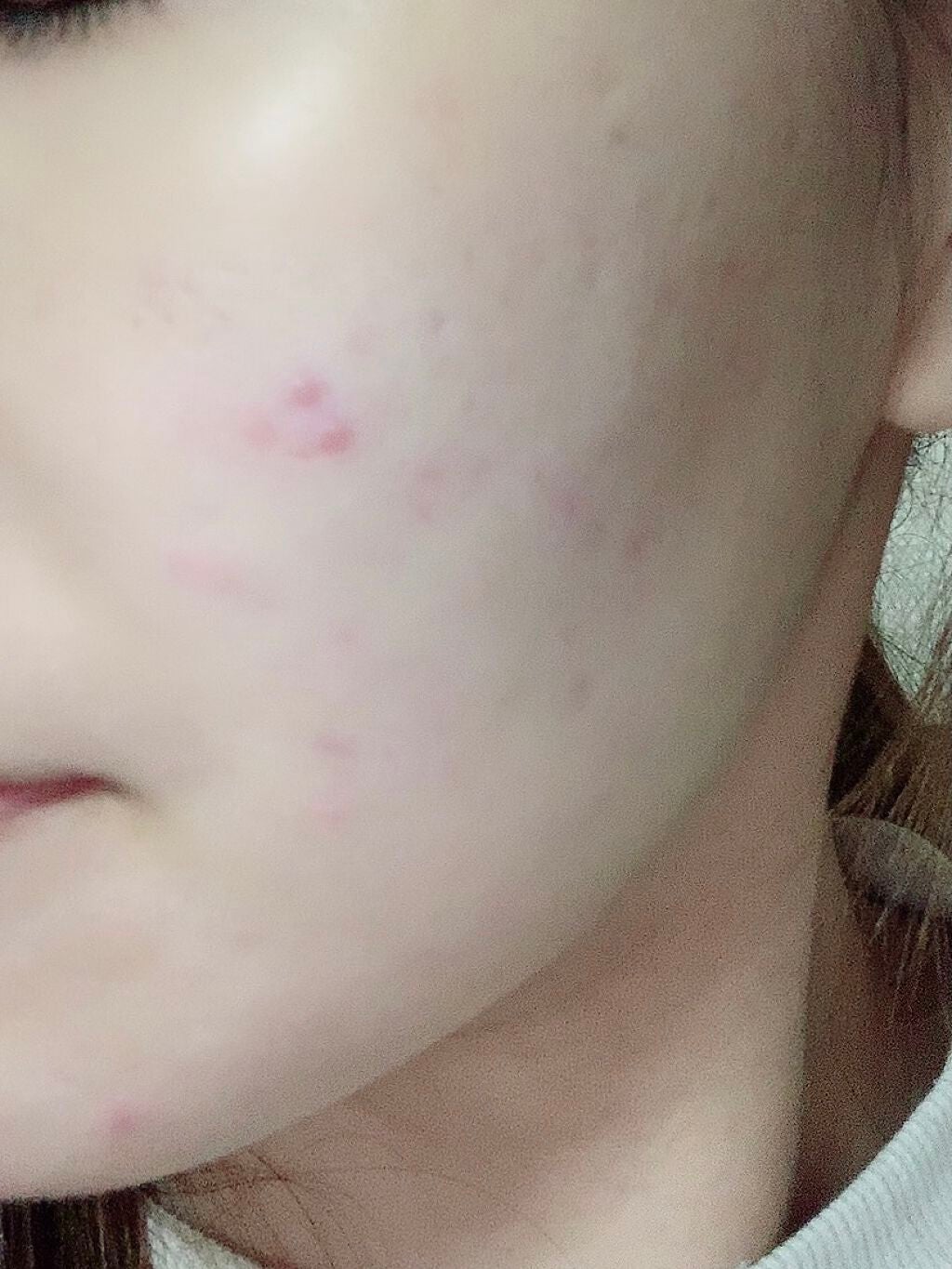 Tð on LIPS ãæçš¿ã§ããªããŸãŸã¹ãã³ã±ã¢å§ããŠçŽ2ã¶æçµã¡ãŸããïŒãããŠã¢ã¯..ãïŒ2æç®ïŒ