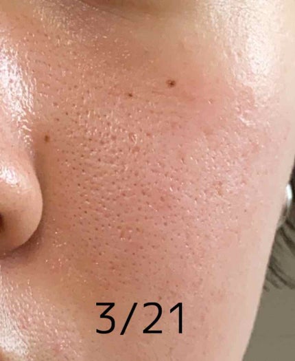 潤浸保湿 化粧水 II しっとり/キュレル/化粧水を使ったクチコミ(3枚目)