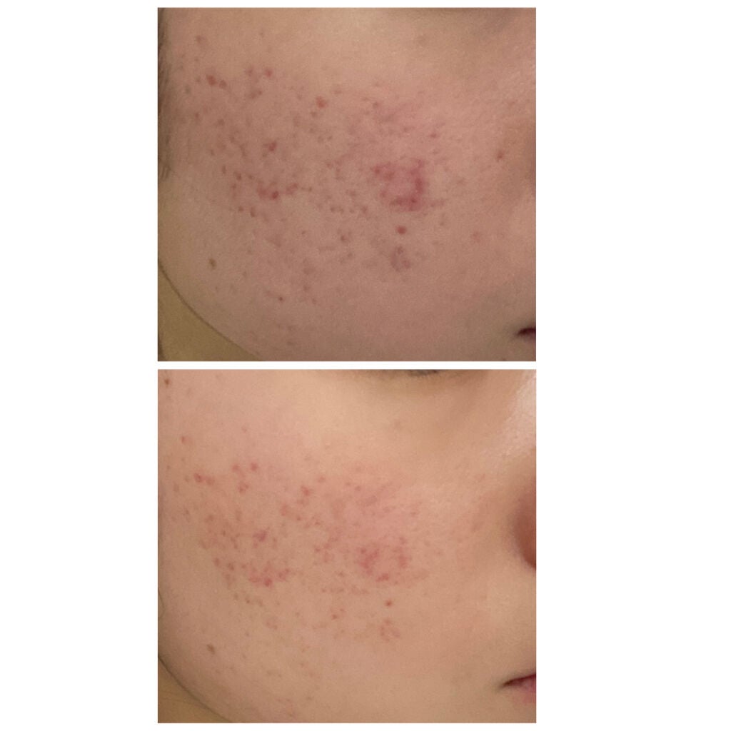 美酢 (希釈タイプ)/美酢(ミチョ)/その他飲むお酢を使ったクチコミ(2枚目)