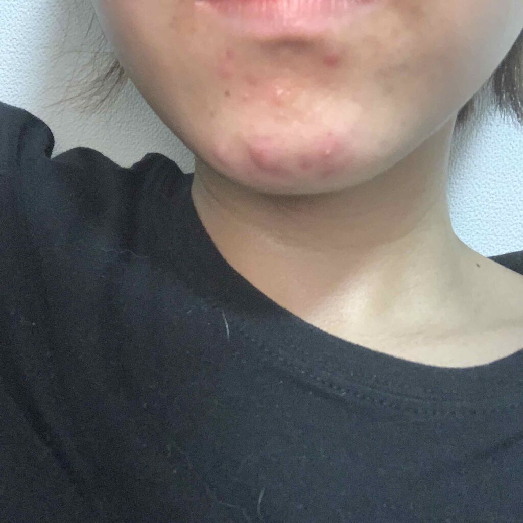 化粧水・敏感肌用・しっとりタイプ/無印良品/化粧水を使ったクチコミ（2枚目）