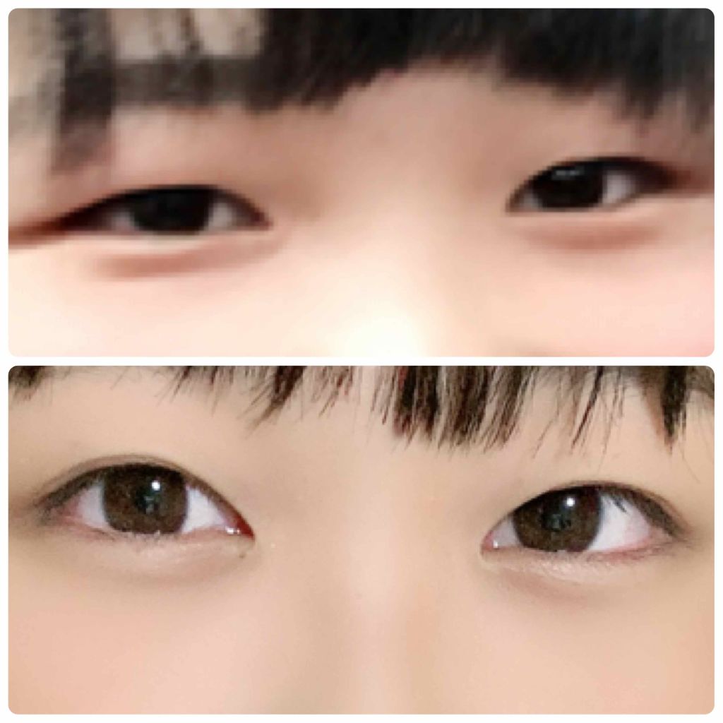 アイビューティー フィクサー WP/アストレア ヴィルゴ/二重まぶた用アイテムを使ったクチコミ（1枚目）
