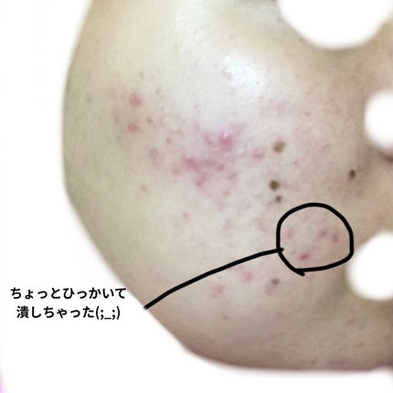 デュオ ザ クレンジングバーム クリア/DUO/クレンジングバームを使ったクチコミ(4枚目)