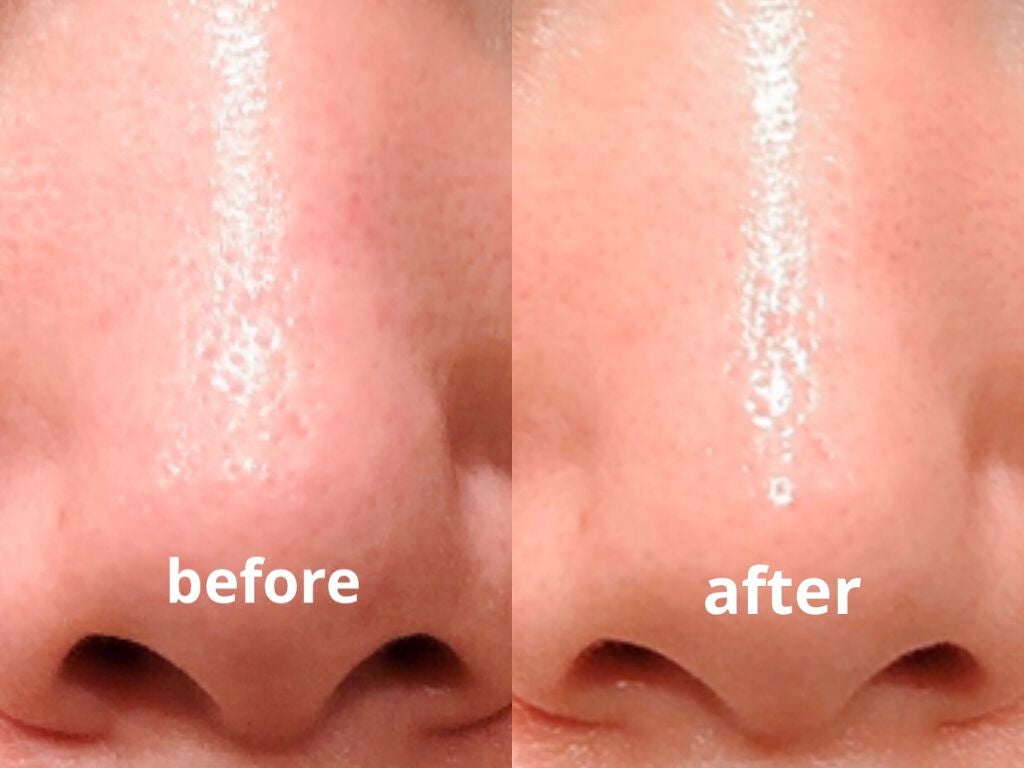 BEBETOXアンプルセット/YOU&ME/スキンケアキットを使ったクチコミ(2枚目)