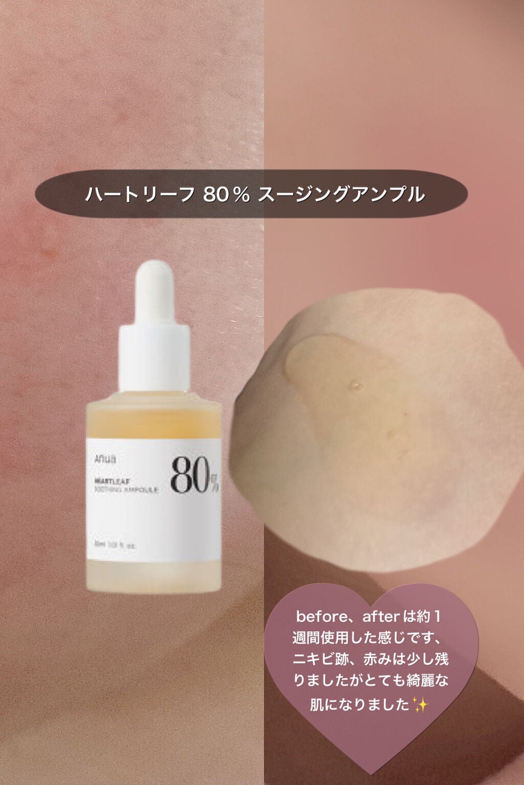 ドクダミ80%スージングアンプル/Anua/美容液を使ったクチコミ(2枚目)