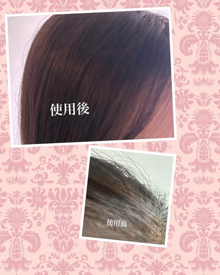 cherry on LIPS 「ビゲン泡クリームカラーを使ってみたよ🩷カラーは4N フォギーブ..」(6枚目)