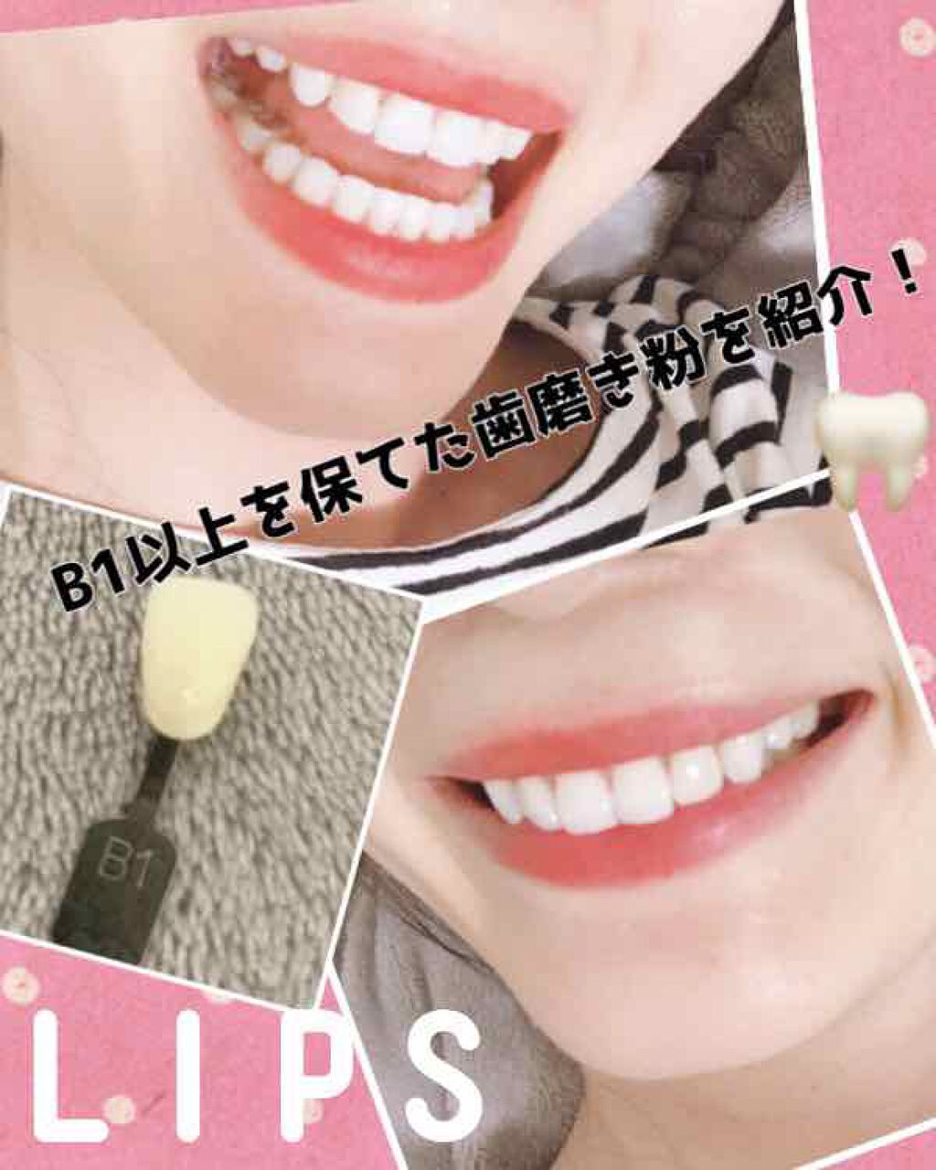 アパガードプレミオ/アパガード/歯磨き粉を使ったクチコミ(1枚目)