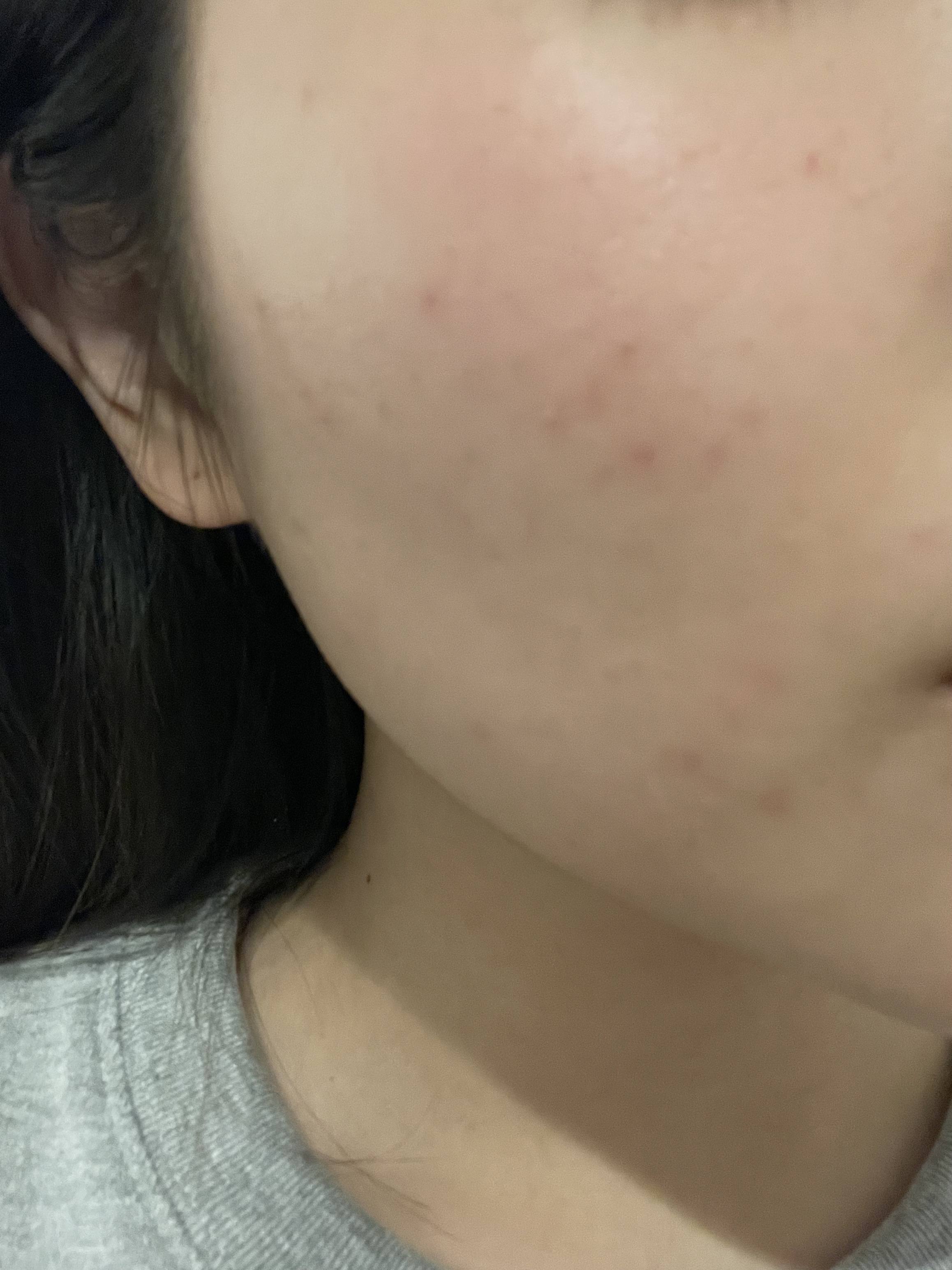 5番 白玉グルタチオンＣ美容液/numbuzin/美容液を使ったクチコミ（2枚目）