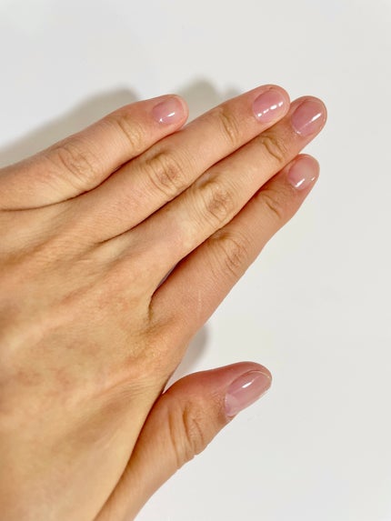 ストロングガード/D-UP/ネイル・ネイルケアを使ったクチコミ(5枚目)