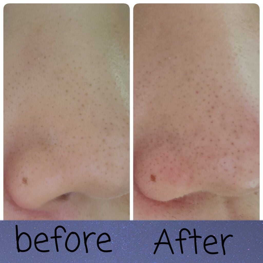 お米のマスク/毛穴撫子/シートマスク・パックを使ったクチコミ(5枚目)