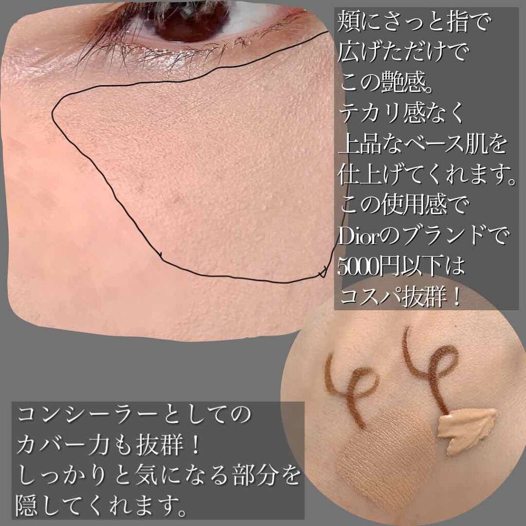 【旧】ディオールスキン フォーエヴァー スキン コレクト コンシーラー/Dior/リキッドコンシーラーを使ったクチコミ（2枚目）