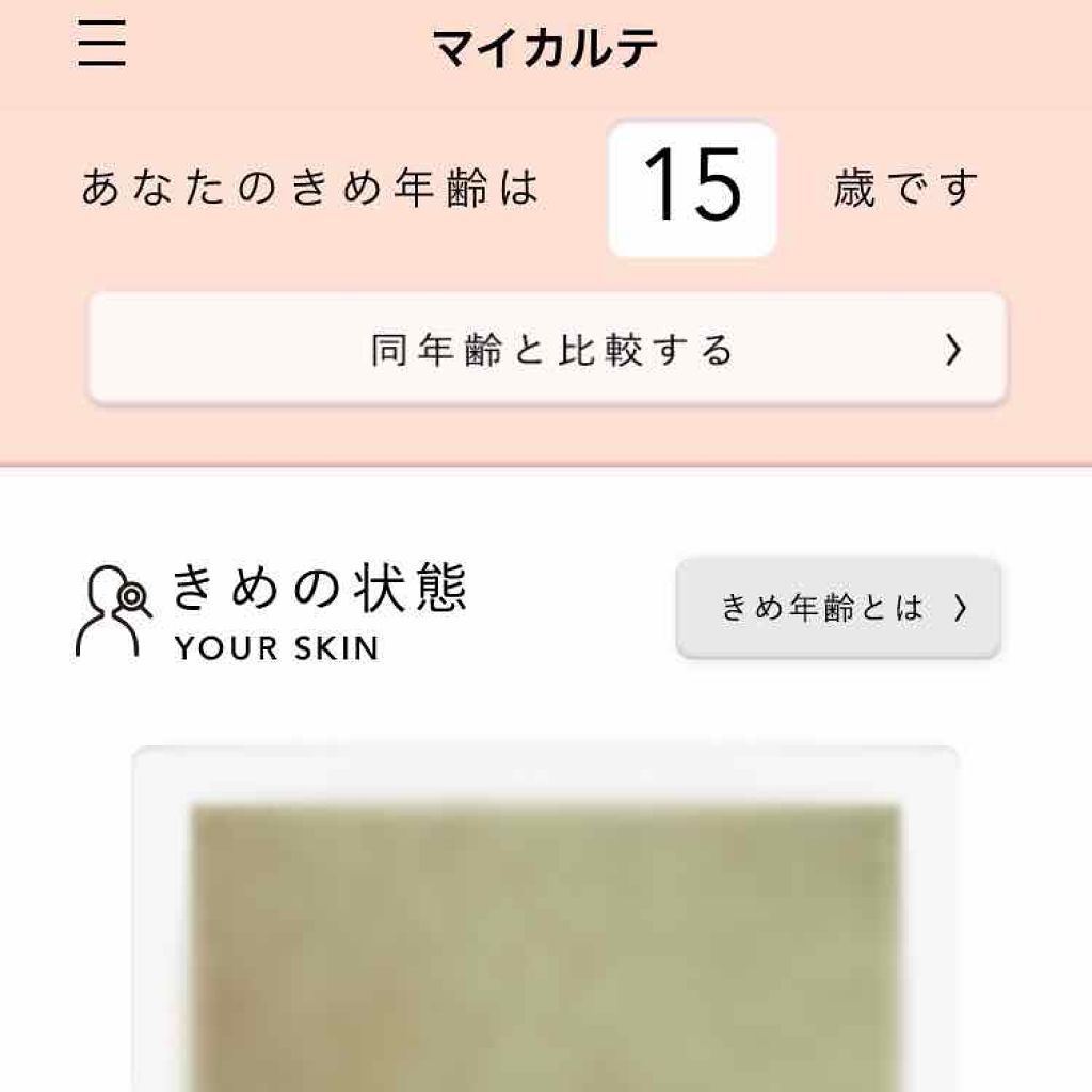 ホワイトアップ ローション(I)/アクアレーベル/化粧水を使ったクチコミ（1枚目）