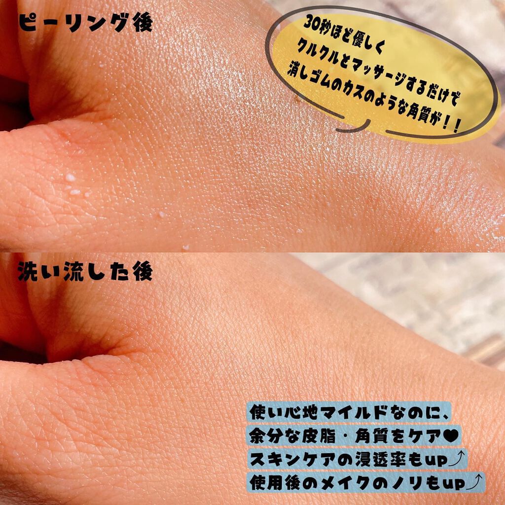 フェイシャルマイルドピーリング/primera/ピーリングを使ったクチコミ(4枚目)
