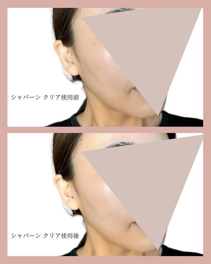 シャバーン/makeumor/美容液を使ったクチコミ(5枚目)