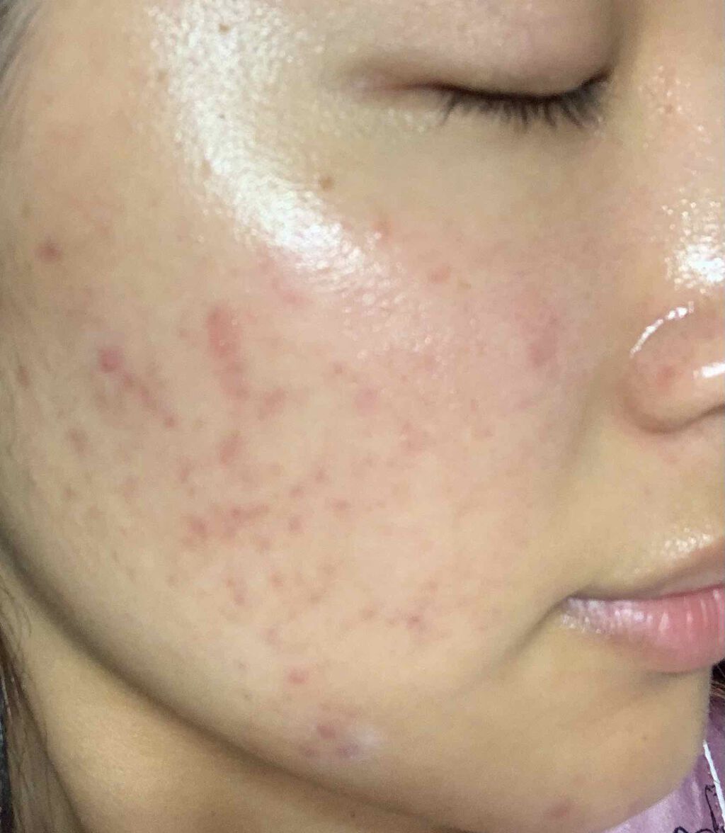 クリアウォッシュ/オルビス/洗顔フォームを使ったクチコミ（2枚目）