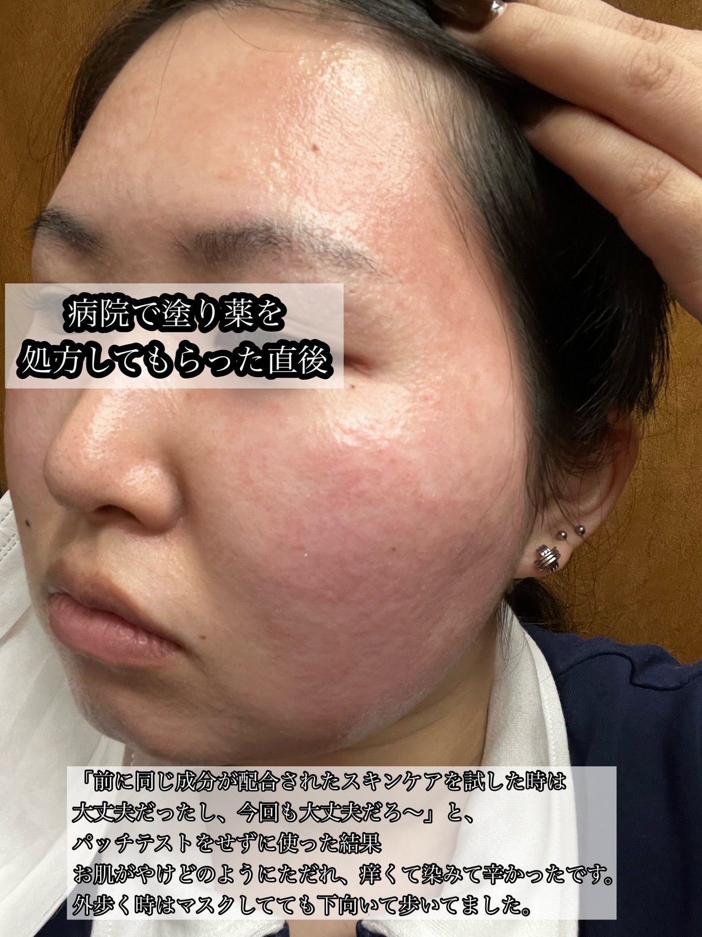 ナイちゃん on LIPS 「「季節の変わり目だし、乾燥しないようにスキンケアを見直そう!」..」(4枚目)